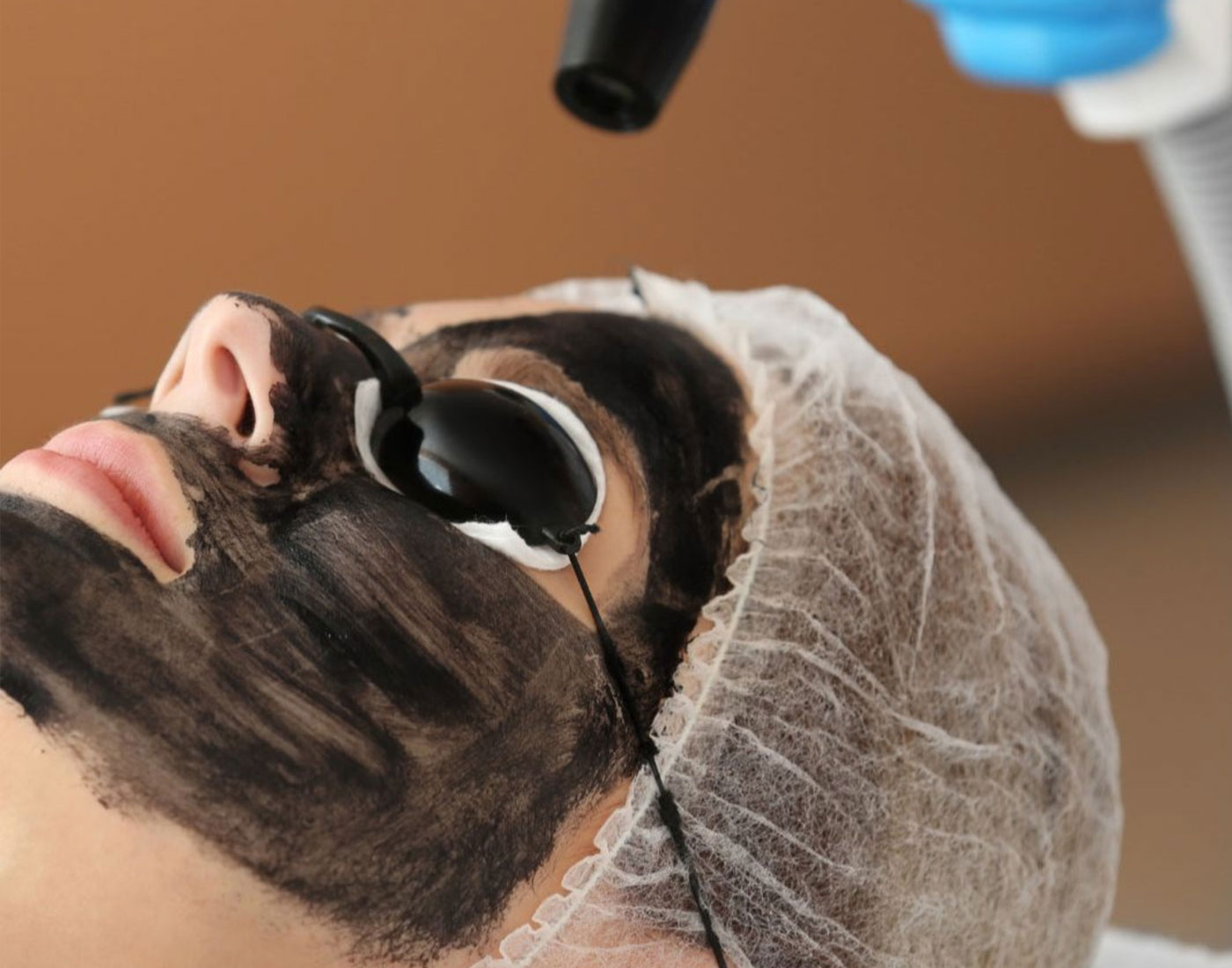Hollywood Peel
