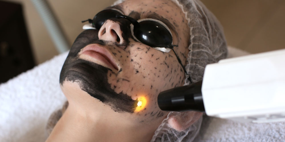 Hollywood Peel